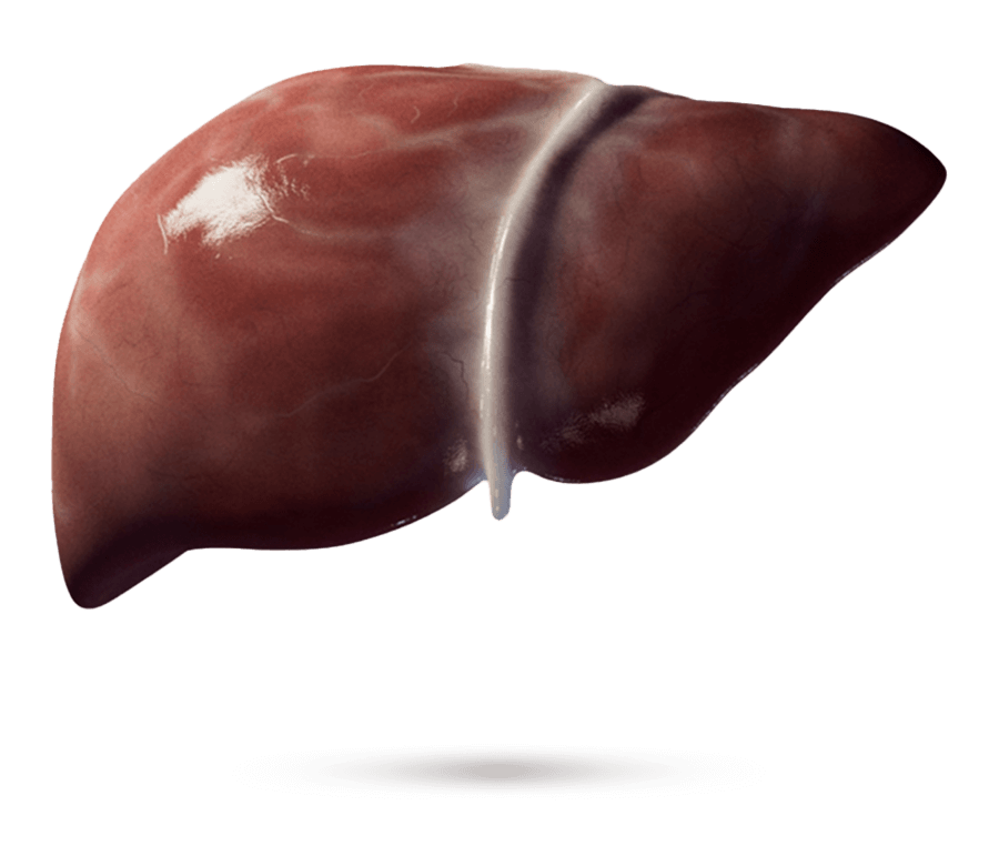 Illustrazione medica di un fegato con fibrosi visibile.